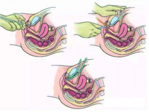 麻麻的尿孔被别人给打开了吗？——开启舒适新时代的全新产品