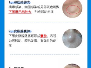 你是否注意到，用舌头舔下颚时会感觉有好多疙瘩？