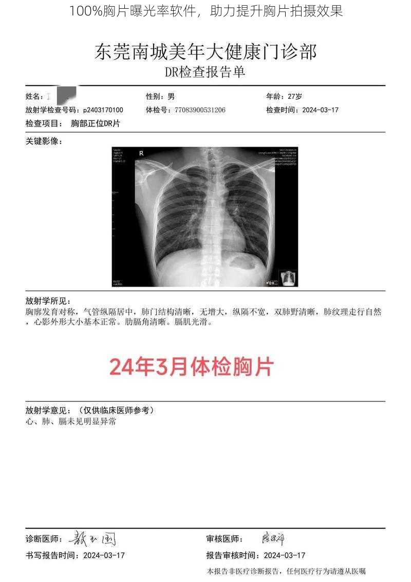 100%胸片曝光率软件，助力提升胸片拍摄效果