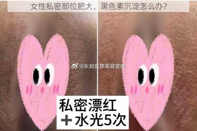 女性私密部位肥大、黑色素沉淀怎么办？